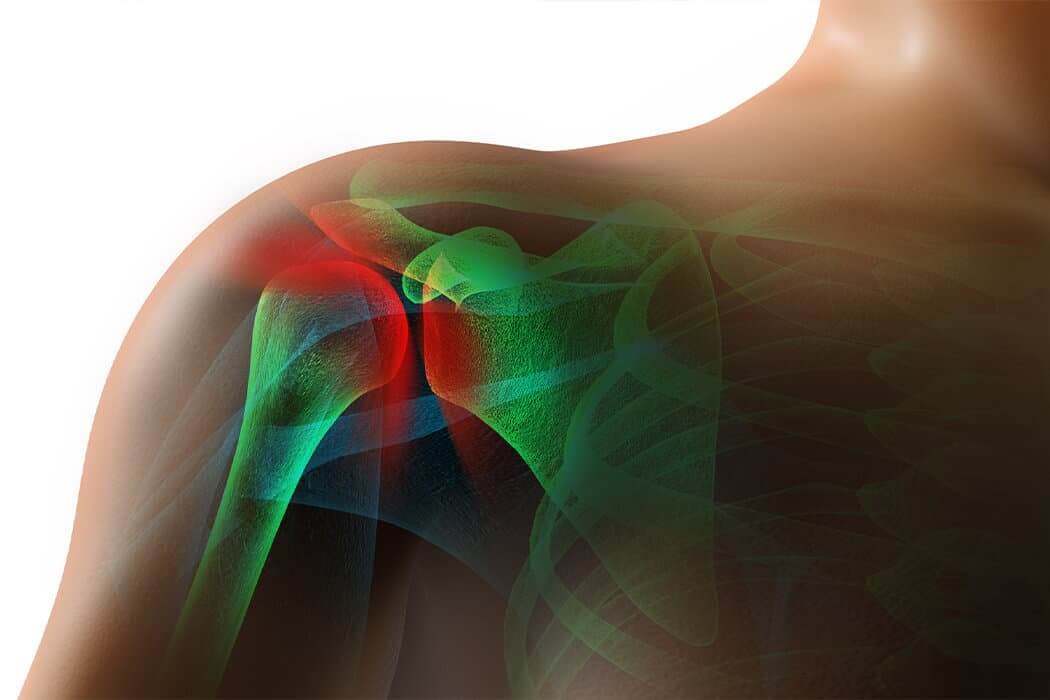 Digital image of the bone structure within a shoulder colored in green and red.